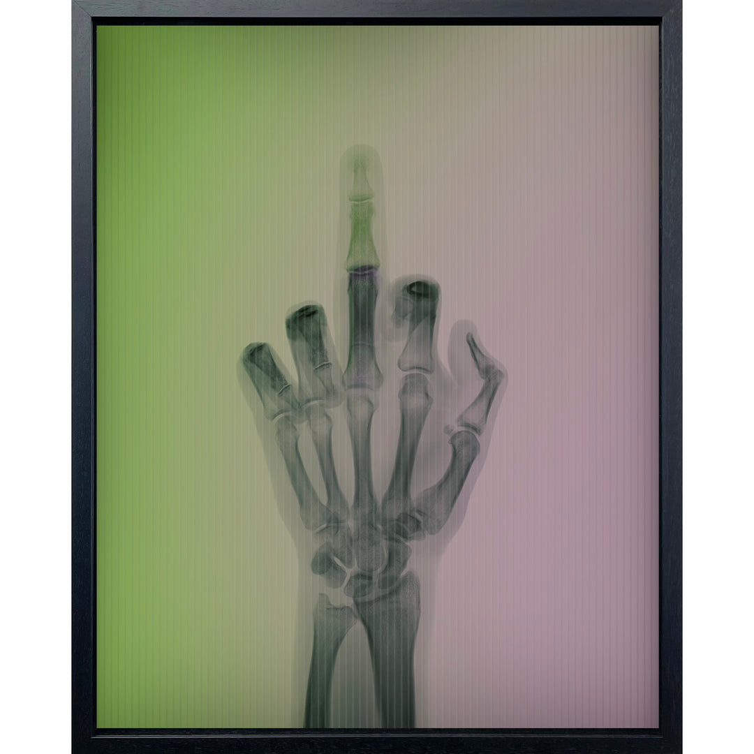 x ray hand with middle finger going up as background color transistions gradient from green to purple