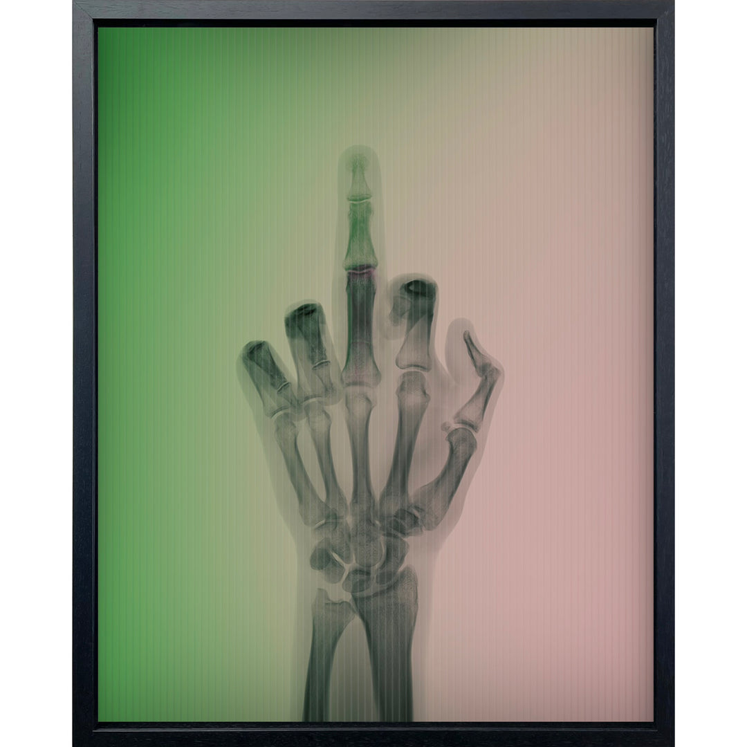 x ray hand with middle finger going up as background transitions gradient color from green to pink